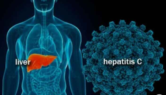 Meningkatkan kewaspadaan hepatitis misterius pada anak-anak: Kementerian Kesehatan. Tiga anak meninggal - Lintas 12 Portal Berita Indonesia